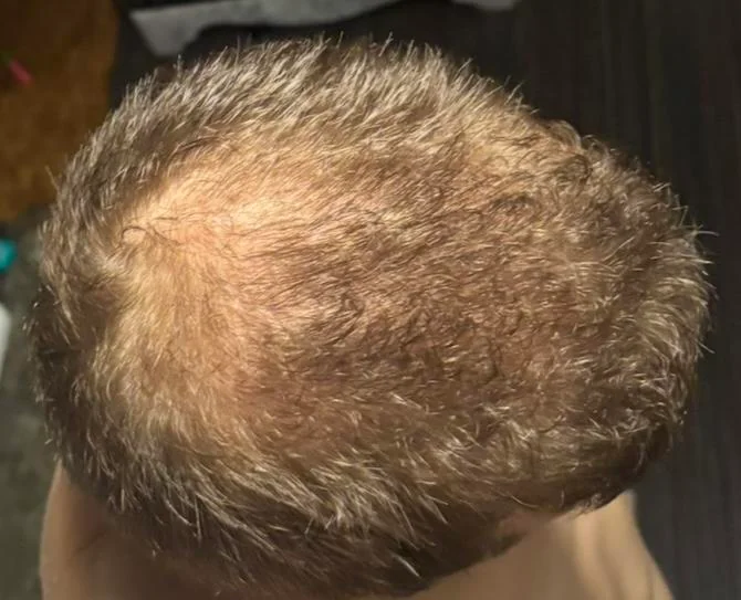 Image #1 from Tony B.