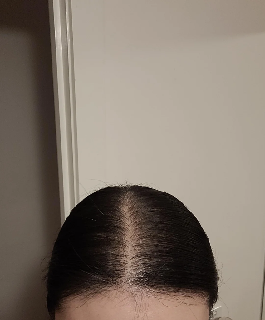 Image #2 from Roberts