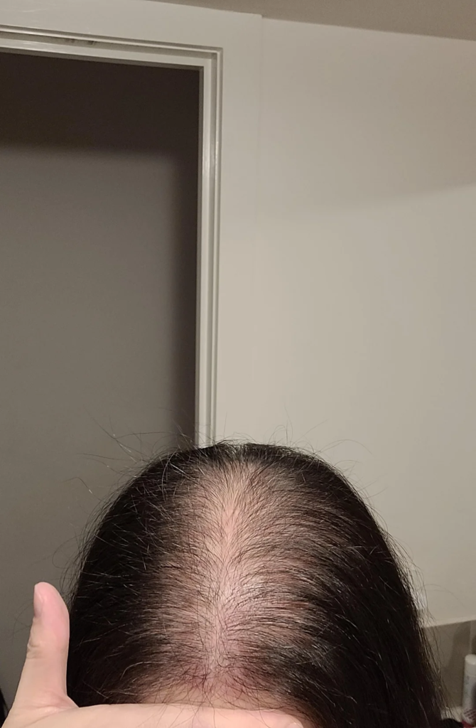 Image #1 from Roberts