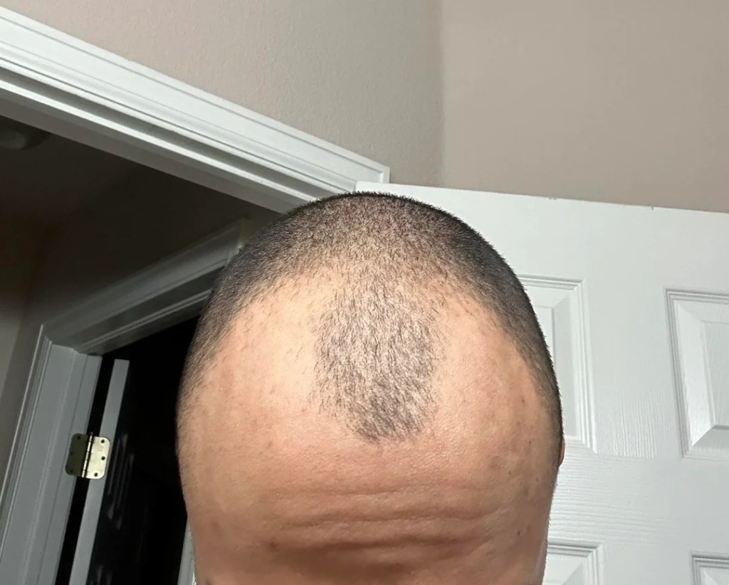 Image #1 from BOGN11