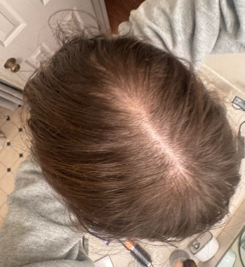 Image #1 from EmmaJohnson