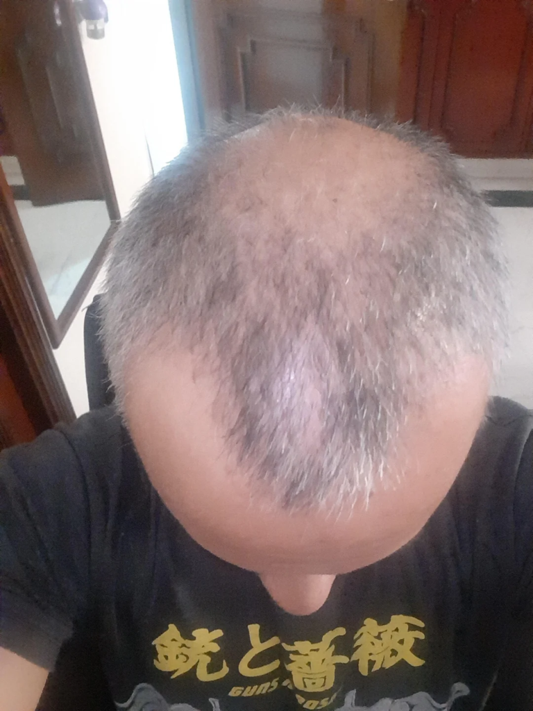 Image #1 from Gary P.