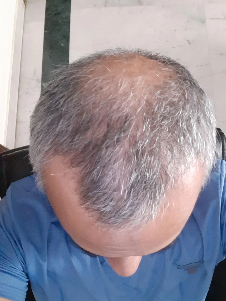 Image #2 from Gary P.