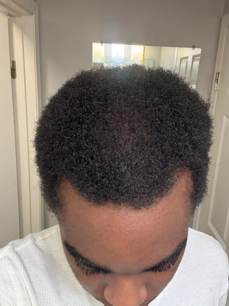 Image #1 from Samuel