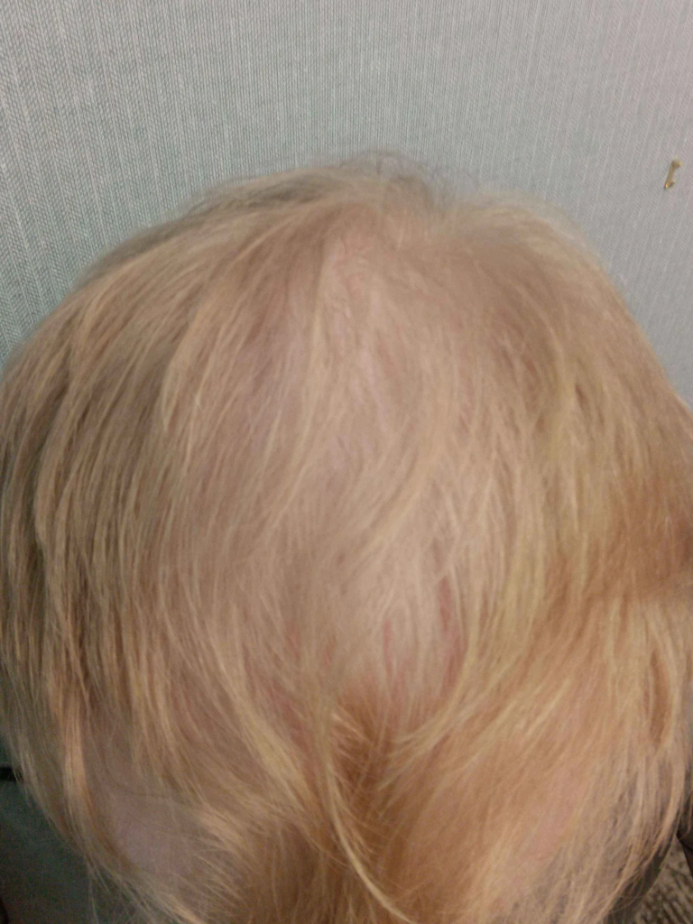 Image #1 from Marcus