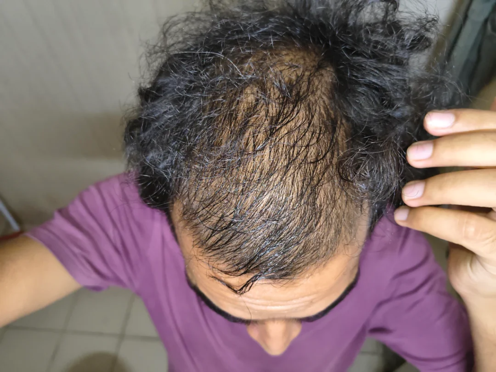 Image #2 from GamerGuy