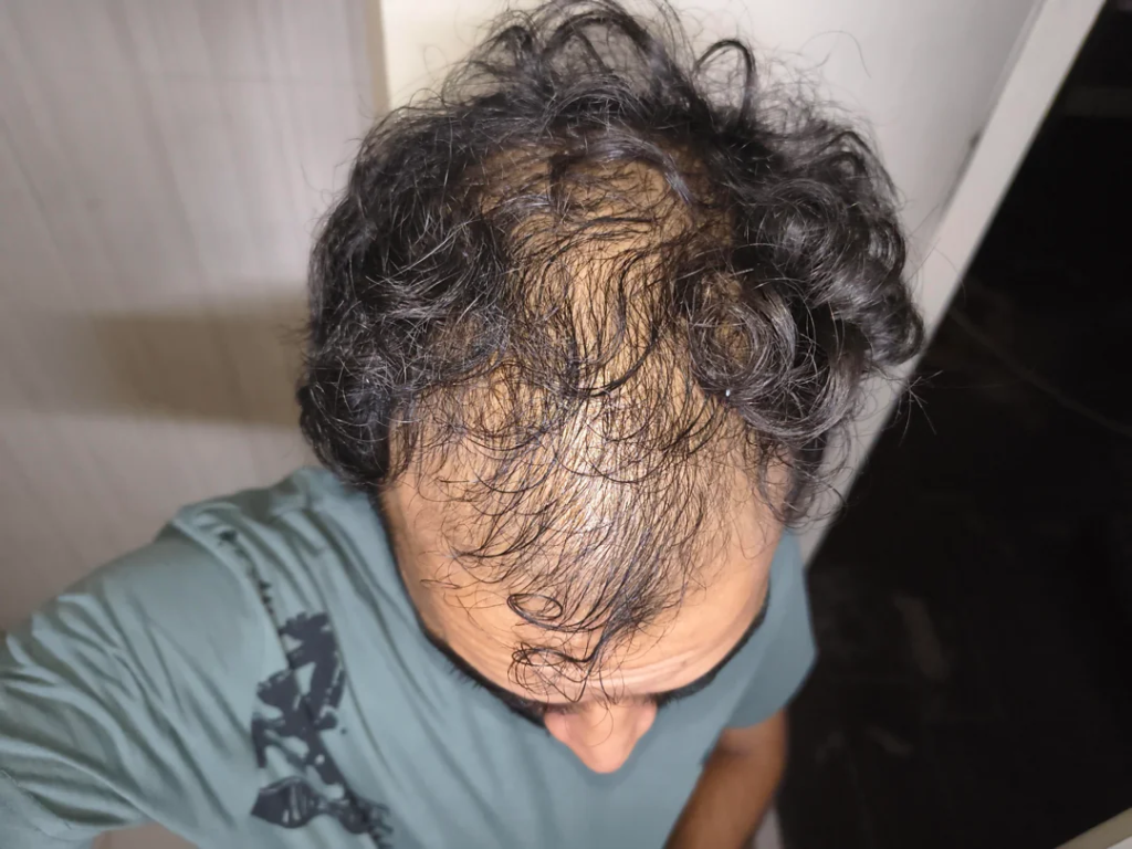 Image #1 from GamerGuy