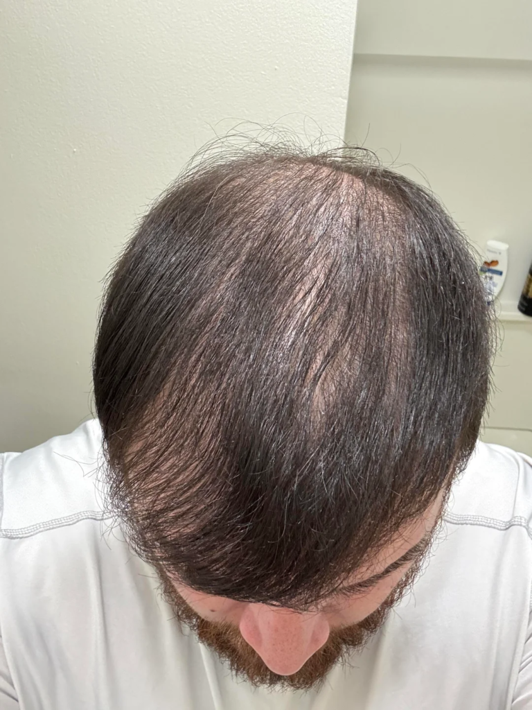 Image #1 from LiamSmith