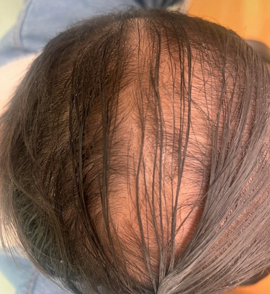 Image #1 from Marcus