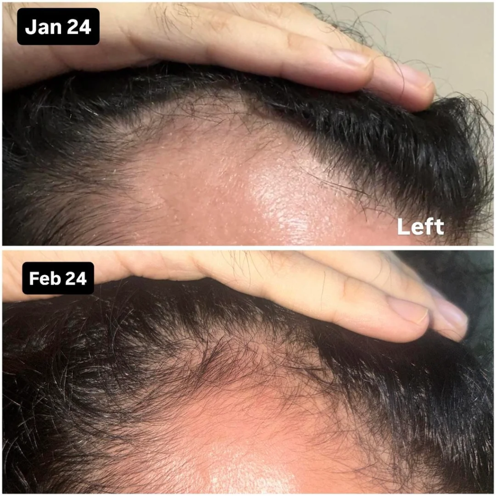 Image #1 from jay johnson