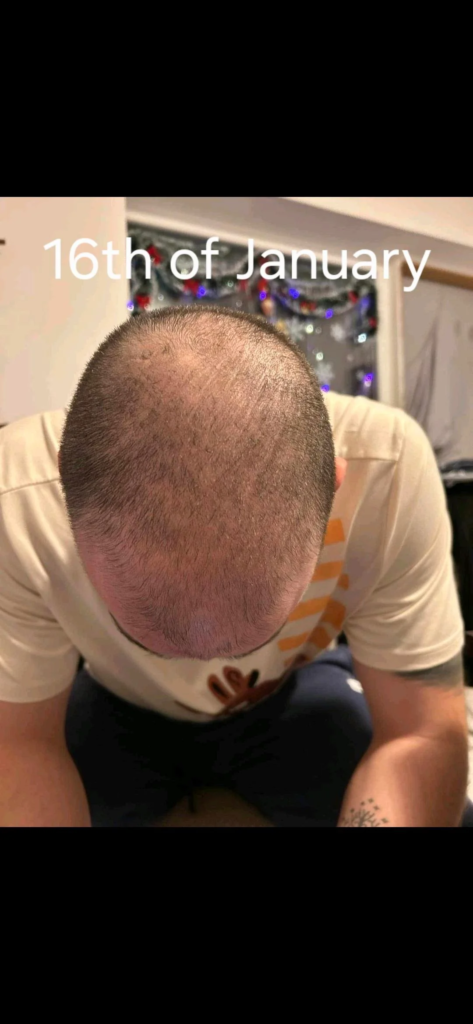 Image #2 from Vellios